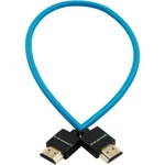 Kondor Blue Braided High-speed Hdmi Cable (blue, 16") New In Box. Fixed Price $24.99.